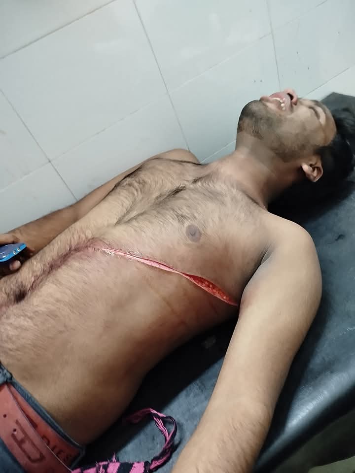 গাইবান্ধায় বৈষম্য বিরোধী ছাত্র আন্দোলনের নেতাদের ওপর সন্ত্রাসী হামলা