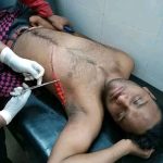 পুলিশের সামনেই ধারালো অস্ত্র দিয়ে আঘাত, বৈষম্য বিরোধী ছাত্রের নেতার উপর