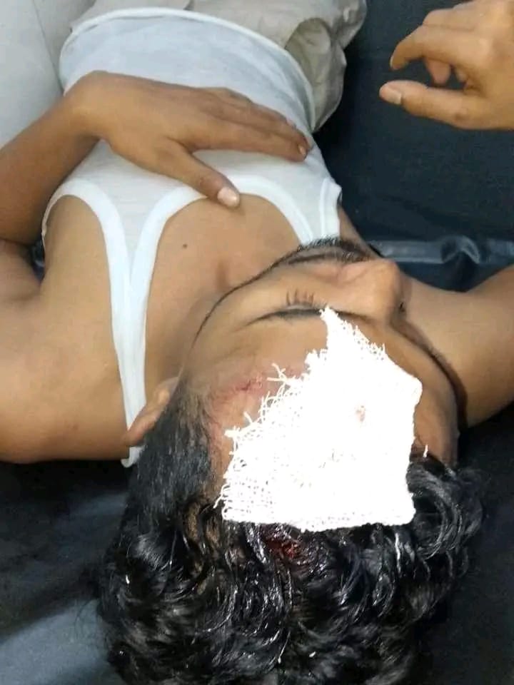 ছাগল গাছ খাওয়াকে কেন্দ্র করে সংঘর্ষ: নারীসহ আহত ৫, স্বর্ণালঙ্কার ও নগদ টাকা লুট